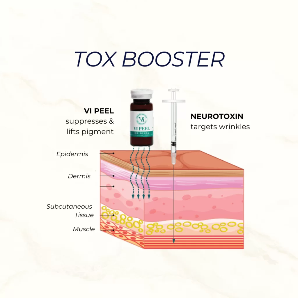 ENHANCE YOUR RESULTS WITH A TOX BOOSTER!  