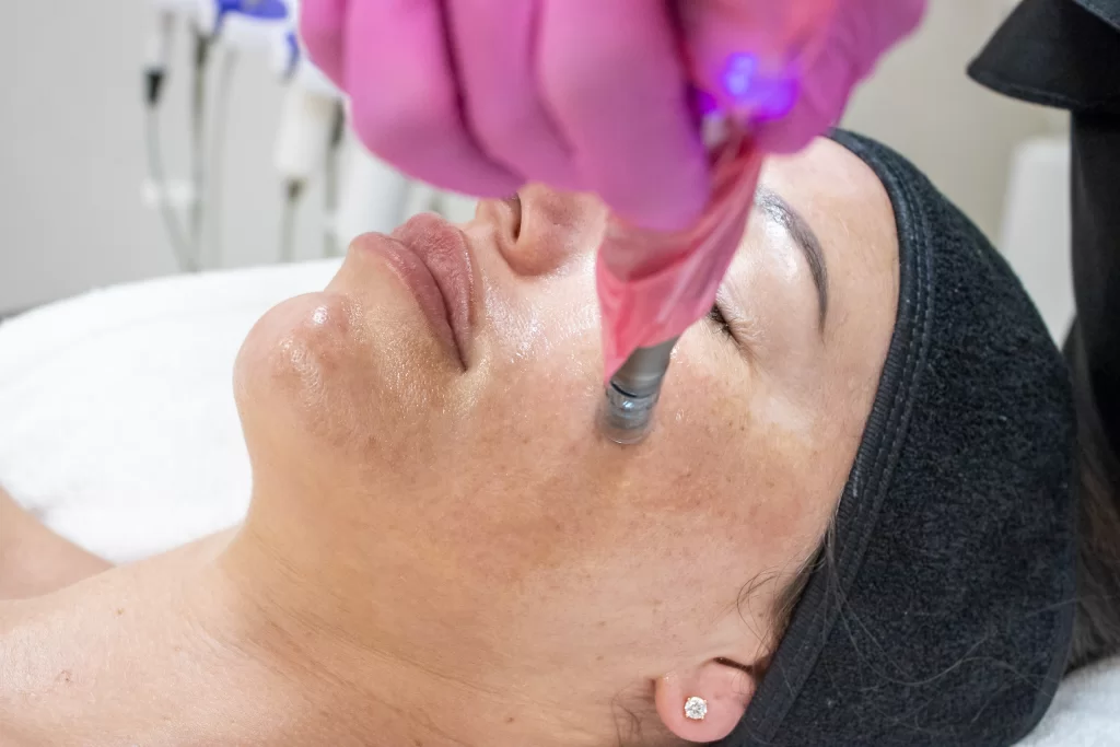hydrafacial